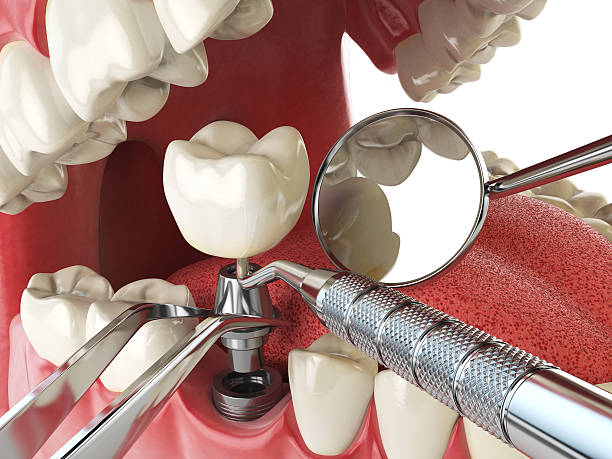 Best Mobile Emergency Dentist in Matta, WA