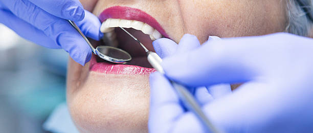 Best Emergency Root Canal Treatment in Matta, WA